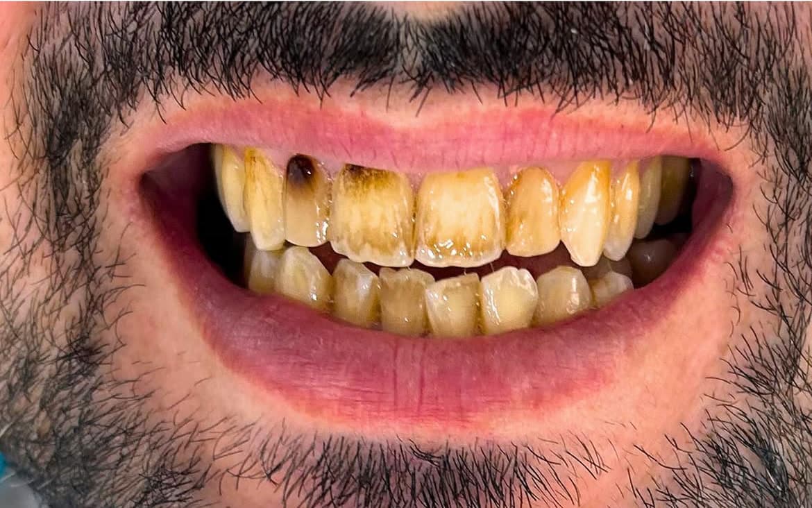 Clinical photographic views of a smile, visible nuances — View 2