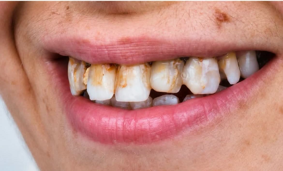 Clinical photographic views of a smile, observable nuances — View 2
